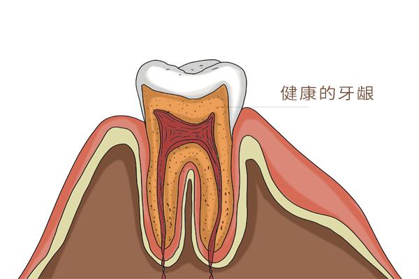 牙齿有黑点和一个洞是蛀牙吗（牙齿上有黑点是蛀牙吗）(4)